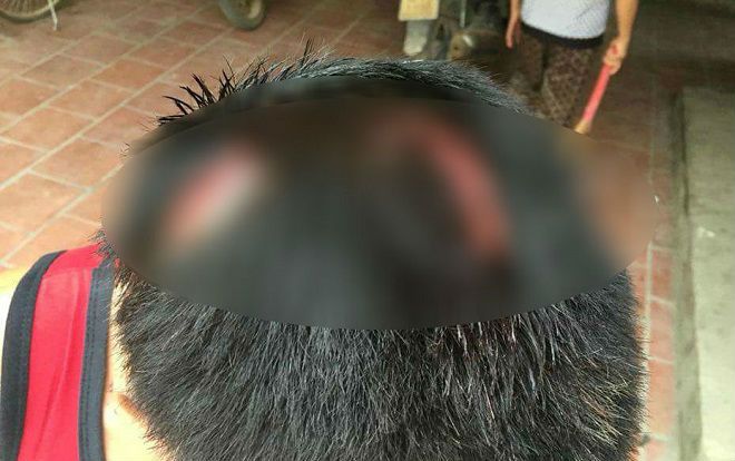 Người đàn ông bị 2 đối tượng dùng tuýp sắt đánh đập rồi bắt quỳ lạy tại quán Karaoke