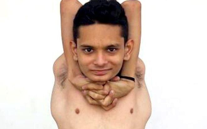 'Cậu bé cao su' có thể xoay ngược đầu ra sau, xoắn vai 360 độ