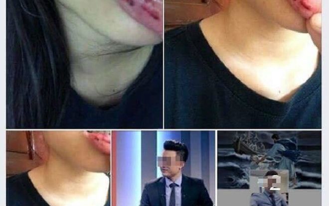 MC Minh Tiệp bị tố đánh em vợ: Thông tin chính thức