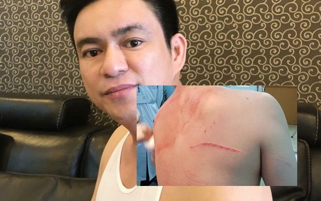 Vợ cũ thuê giang hồ truy sát bác sĩ Chiêm Quốc Thái với giá 1 tỷ đồng