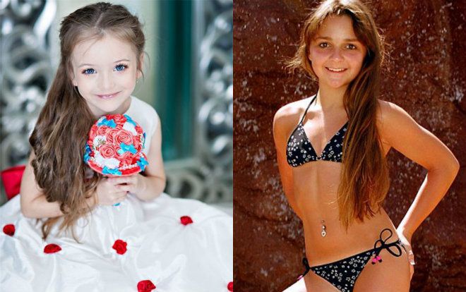 Hệ luỵ cay đắng phía sau ánh hào quang của nghề mẫu nhí