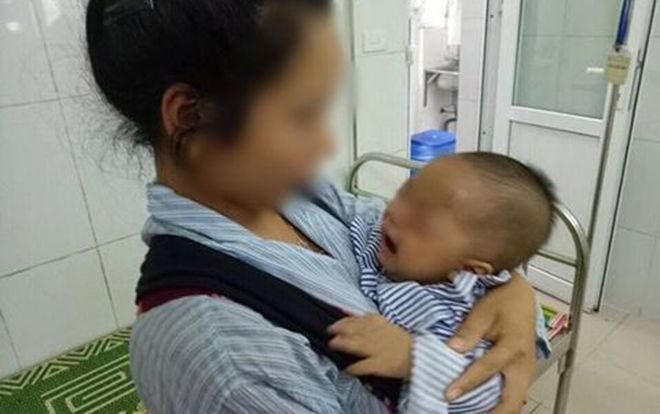 Người mẹ trẻ 18 tuổi nhỏ sữa vào mắt con khiến trẻ hỏng một bên mắt