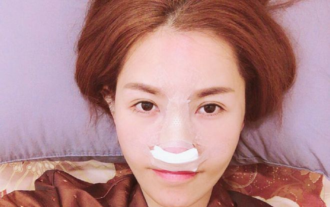 Quế Vân, Thu Thủy, hay chuyện những chiếc mũi biết nói