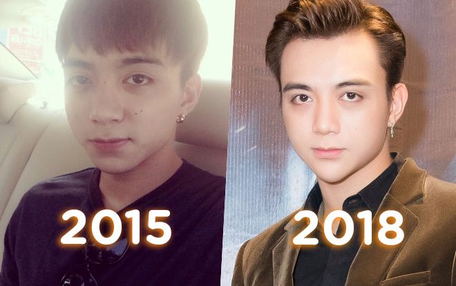 Ngày càng khó nhận ra 'Soobin Hoàng Sơn của ngày hôm qua' vì chiếc cằm nhọn khác lạ