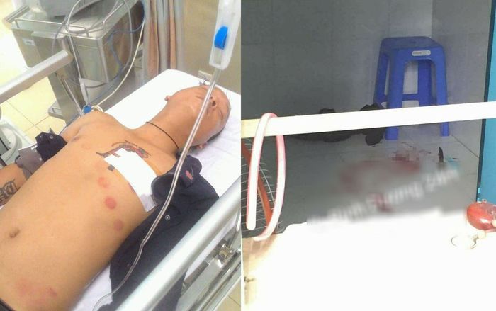 Sát hại bạn gái rồi tự tử nhưng không thành, cơ quan điều tra đợi đối tượng tỉnh lại để lấy lời khai