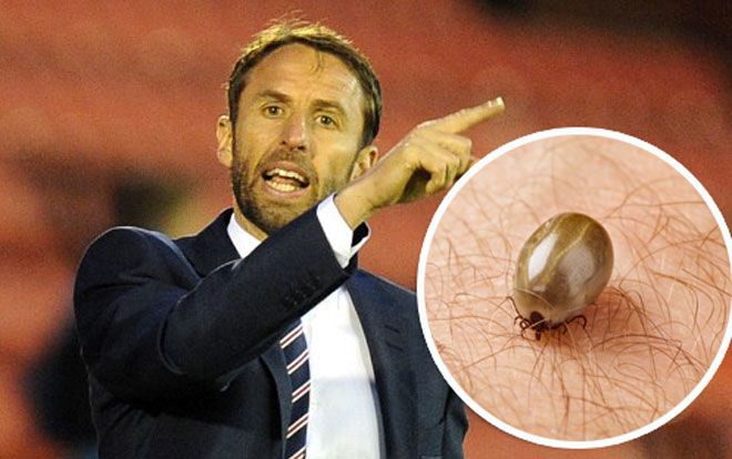 Cảnh báo căn bệnh chết người cho các tuyển thủ tới Nga dự World Cup 2018