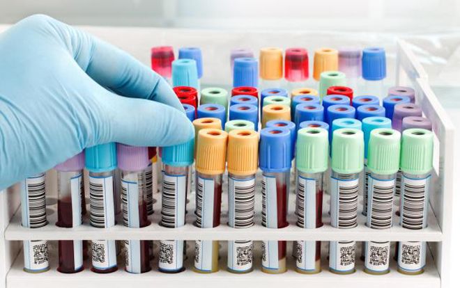 Bất cẩn, bác sĩ Trung Quốc gây lây nhiễm HIV cho 5 người