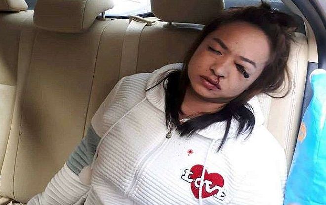 Sử dụng chì kẻ mắt khi đang ngồi xe ô tô, cô gái nhận kết thảm