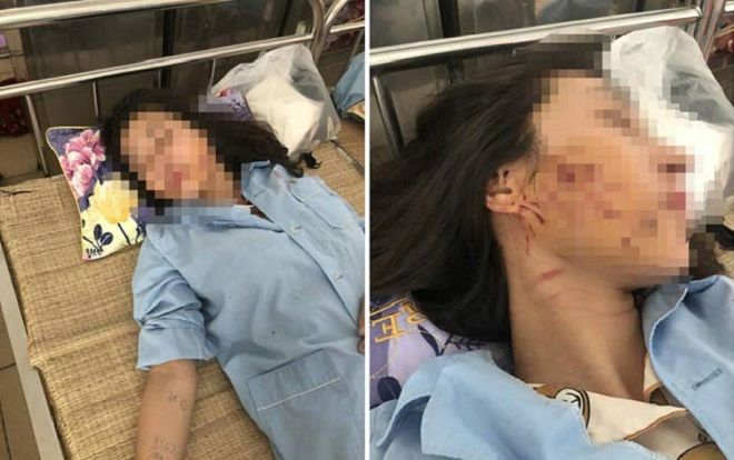 Vụ đánh ghen kinh hoàng: Cô gái bị lột đồ, đổ nước mắm và muối ớt vào người lên tiếng