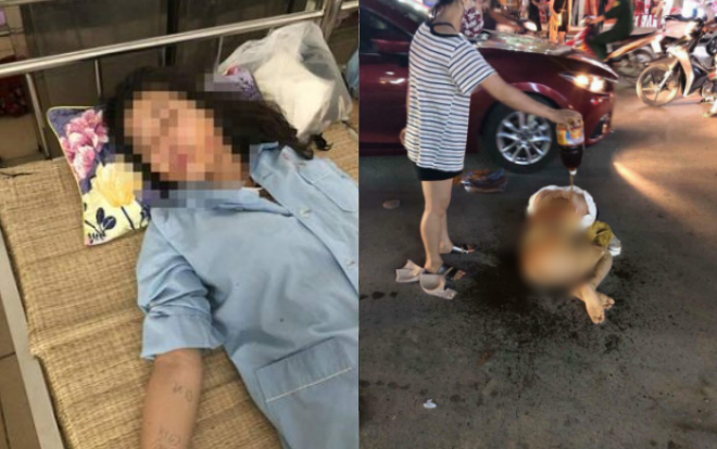 Chủ tiệm spa bị lột đồ, đổ nước mắm và muối ớt nghi do đánh ghen đề nghị khởi tố vụ án