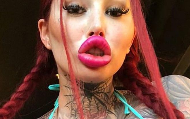 Chi hơn 2,5 tỷ cho vô số ca phẫu thuật, cô gái trở thành Angelina Jolie phiên bản lỗi