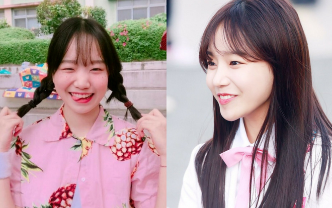 Thí sinh ‘Produce 48’, Yuri bị chỉ trích thậm tệ vì tin đồn phẫu thuật thẩm mĩ