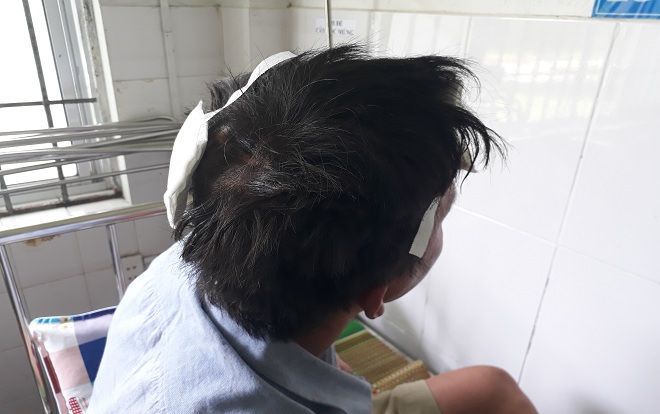 Bị hàng xóm chém tới tấp vào đầu vì thắc mắc kèo độ World Cup