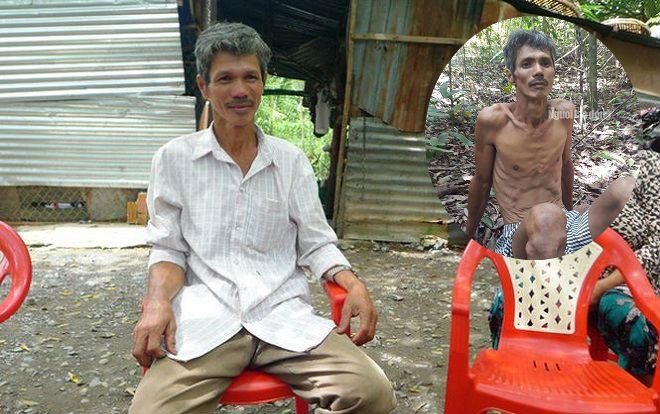 Thầy giáo được tìm thấy trong tình trạng không mảnh vải che thân trong rừng nói gì về quá trình mất tích và sống sót kì diệu?
