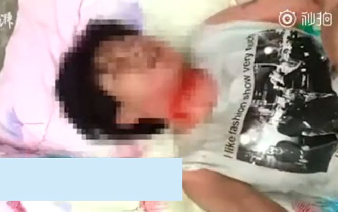 Đánh ghen bất thành, bà vợ đổ nước sôi nóng vào miệng con của tình địch