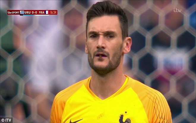 HY HỮU: Lloris bị chuồn chuồn bay vào miệng tại World Cup