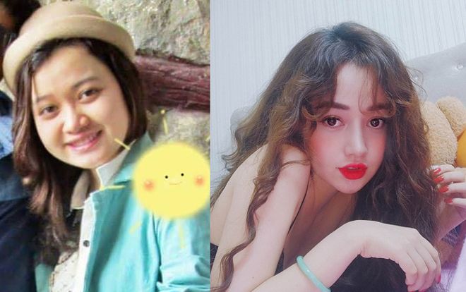 Cô gái 9x gây sốt mạng xã hội vì lột xác không ai nhận nhờ ra phẫu thuật thẩm mỹ