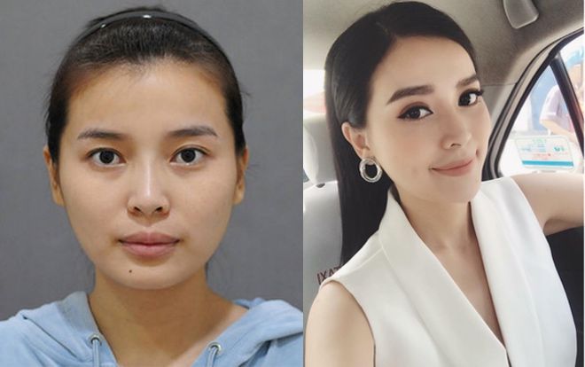 Vừa mới hot nhờ trúng vai Trung úy Minh Ngọc (Hậu duệ mặt trời Việt), Cao Thái Hà đã bị 'đào mộ' ảnh thời chưa thẩm mỹ