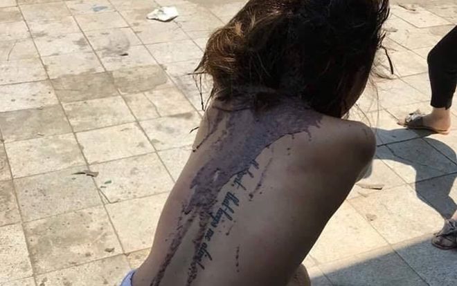 Xôn xao hình ảnh cô gái trẻ bị lột đồ đổ dầu luyn và mắm tôm đầy người nghi do đánh ghen
