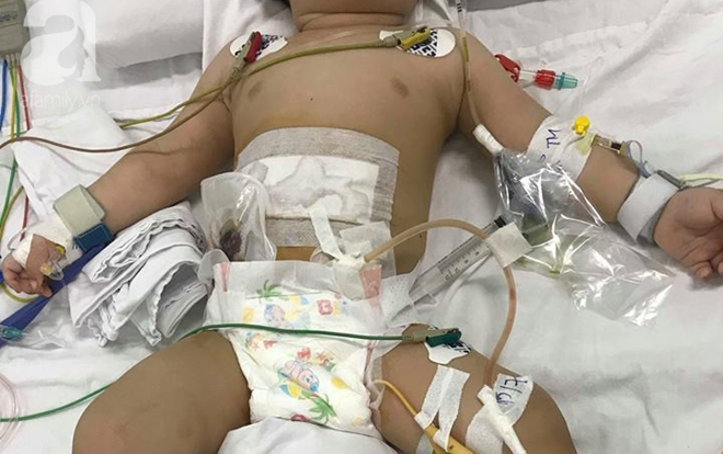 Xót lòng bé trai 11 tuổi bị chính mẹ ruột dùng dao đâm nhiều nhát vào bụng