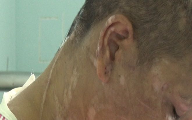 Đi làm thuê, bị chủ đánh đập biến dạng đến mẹ đẻ nhận không ra