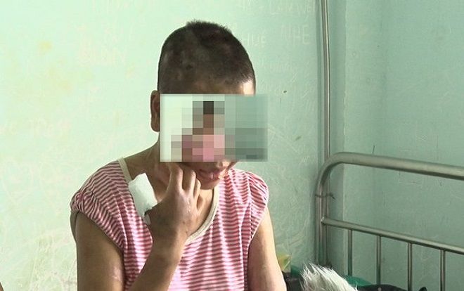 Vụ đi làm thuê bị chủ nhà tra cắt tai, ủi bàn là lên mặt - Thiếu nữ muốn bỏ trốn thì bị dọa: 'Chỉ cần về tới nhà là thấy xác mẹ nằm đó'