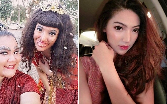 Xôn xao câu chuyện hot girl từng bị 'đá' vì răng hô xấu xí, để rồi lột xác ngỡ ngàng