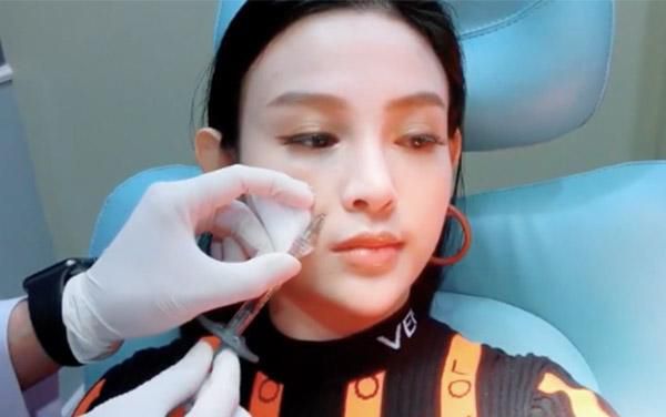 Huyền Baby gây sốc khi đăng tải clip tiêm filler để giữ khuôn mặt không tuổi
