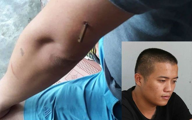 Vụ chủ quán cà phê bị côn đồ dùng súng bắn trước cửa nhà: Nạn nhân bị bắn ngay sau khi mở lời 'tao không nợ gì mày'