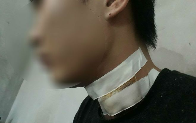 Tài xế taxi bị khách cầm dao khống chế cứa cổ trong đêm