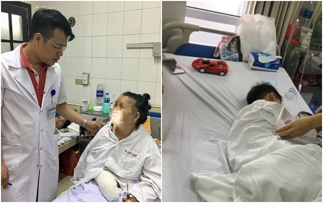 Thêm 2 trường hợp bị chó cắn đứt rời môi vĩnh viễn, lóc da bàn tay