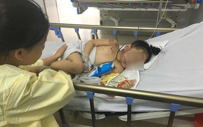 Bé gái may mắn sống sót trong vụ tại nạn thảm khốc ở Quảng Nam: 'Mẹ ơi! Mẹ mua bim bim cho con với!'