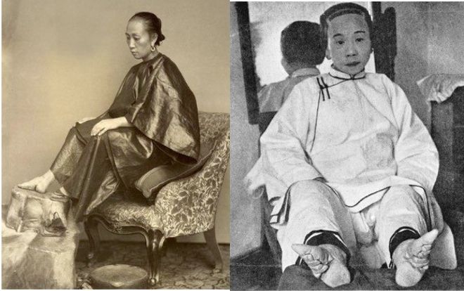 9 xu hướng làm đẹp 'kinh dị' nhất trong lịch sử nhân loại