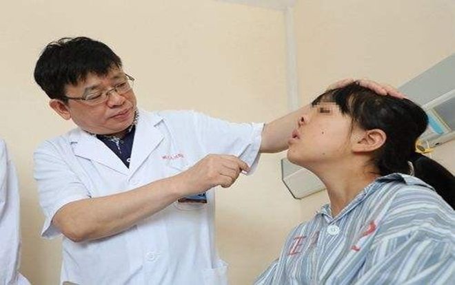 Cô bé sinh ra với 3 lỗ mũi và khuôn mặt bị biến dạng suốt 16 năm