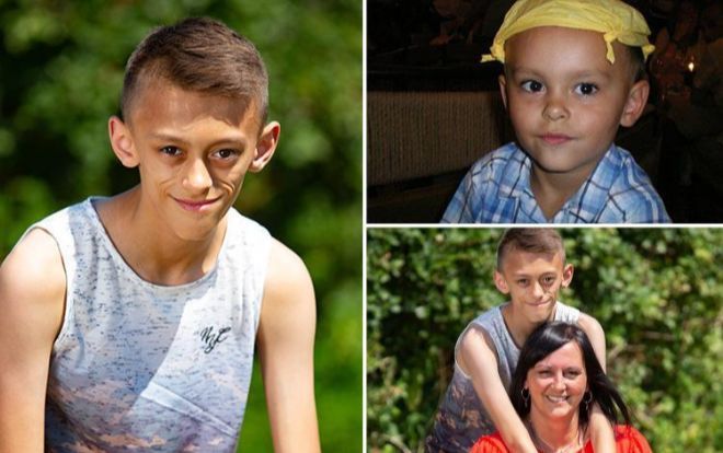 Virus bí ẩn khiến cậu bé 11 tuổi trông như cụ ông 70