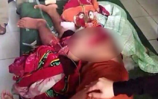 Lao xuống biển cứu con, người mẹ bị cánh quạt của tàu chém đứt lìa đùi phải, con trai 8 tuổi tử vong