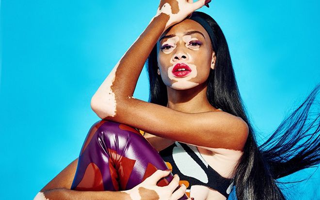 Các nàng mẫu dị biệt phá vỡ định nghĩa cái đẹp của làng thời trang khắc nghiệt