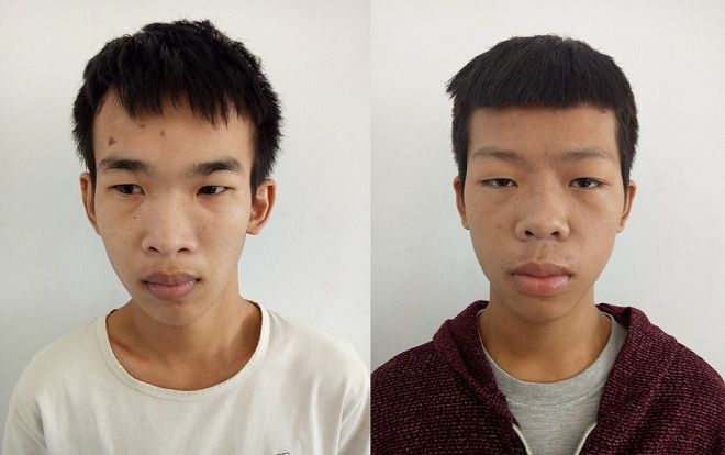 Nam sinh 15 tuổi cùng bạn gái bị nhóm thanh thiếu niên chém gục giữa đường