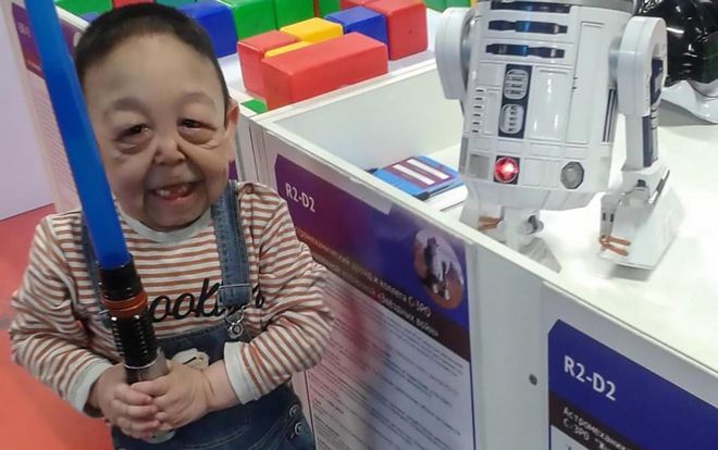 Cậu bé 6 tuổi da nhăn nheo, chảy xệ trông không khác cụ già 60