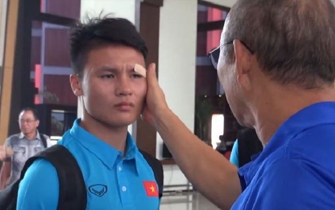 Quang Hải phụng phịu để HLV Park Hang Seo dán lại vết rách ở mắt