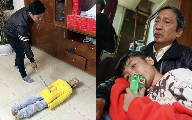 Sắp xét xử vụ cha đẻ cùng mẹ kế bạo hành con trai 10 tuổi rạn 6 xương sườn