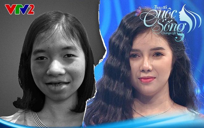 Hành trình tìm lại nụ cười của cô gái 'ma cà rồng' sau 18 năm