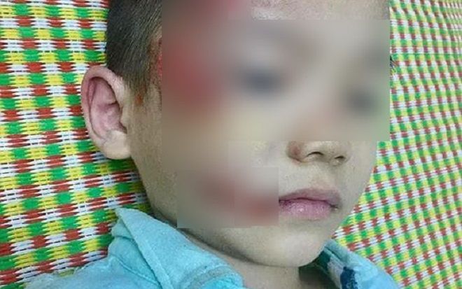 Mải buôn điện thoại để mặc bệnh nhi trong đau đớn, nữ y tá bị giáng chức xuống làm hộ lý