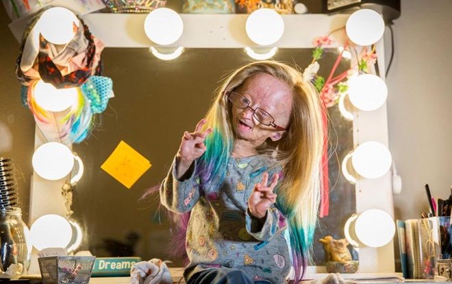 Bé gái mang hình thể lão hóa vẫn trở thành ngôi sao YouTube với hàng triệu người ngưỡng mộ