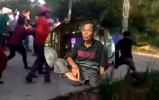 Truy tìm nhóm thanh niên bịt mặt hành hung người dân đến ngất xỉu