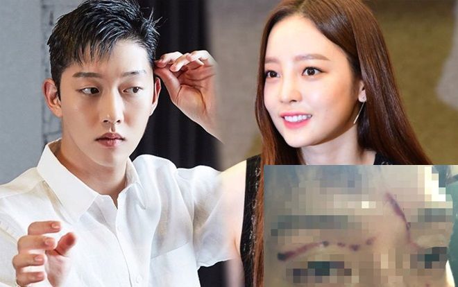 'Shock' khi Goo Hara phá hủy gương mặt 'mỹ nam' của bạn trai - từng được cho là giống Yoo Ah In và Nam Joo Hyuk