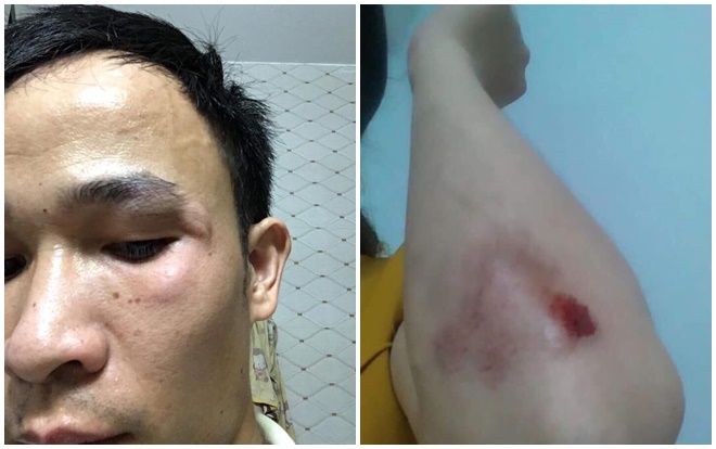 Nam thanh niên đi xe SH tấn công cả bà bầu đang mang thai 8 tháng sau va chạm nhỏ gây bức xúc