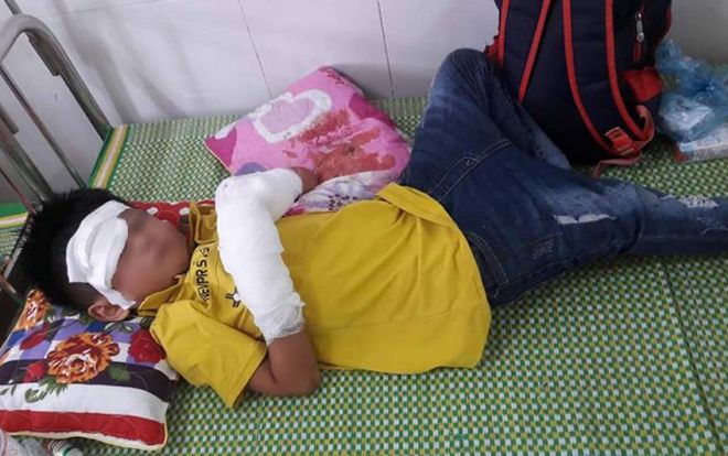 Vụ bé trai dập nát 2 bàn tay vì điện thoại phát nổ: Những lưu ý ai cũng cần nắm rõ để tránh tai nạn đáng tiếc