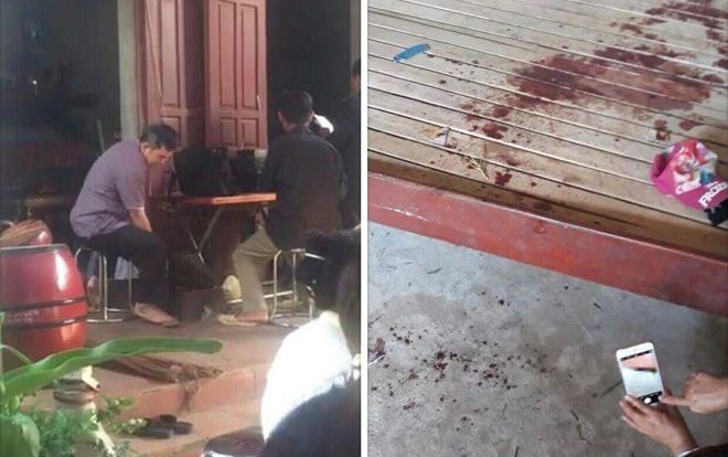 Bé gái 10 tuổi bất ngờ bị đứt cổ, tử vong trên đường đi cấp cứu