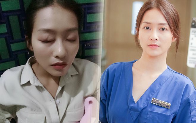 Vùng mắt của Khả Ngân bị sưng to trong lúc đang quay 'Hậu duệ mặt trời Việt Nam'